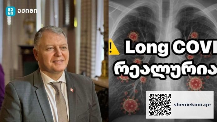 Long COVID რეალურია — მეცნიერებმა პირველად შეძლეს ვირუსული ცილოვანი ფრაგმენტების იდენტიფიცირება იმ ადამიანების სისხლში, რომლებსაც გრძელვადიანი COVID (Long COVID) აწუხებთ