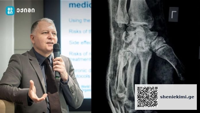biocebo moetxilobas agadgens ჩინელმა მეცნიერებმა შექმნეს ძვლის ბიოწებო, რომელიც მოტეხილობას მხოლოდ 3 წუთში აღადგენს
