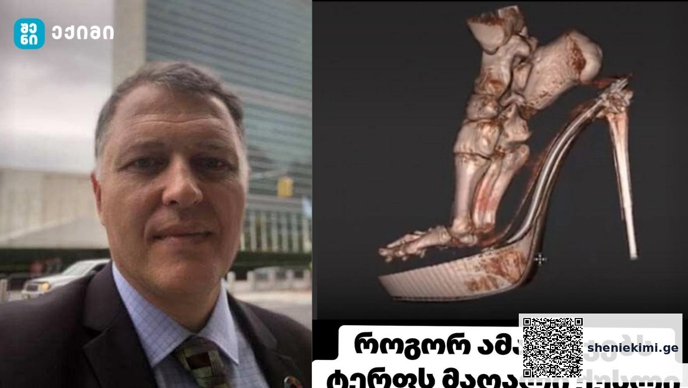 შედეგი შოკისმომგვრელია – როგორ ამახინჯებს ტერფს მაღალი ქუსლი | sheniekimi.ge | შენი ექიმი