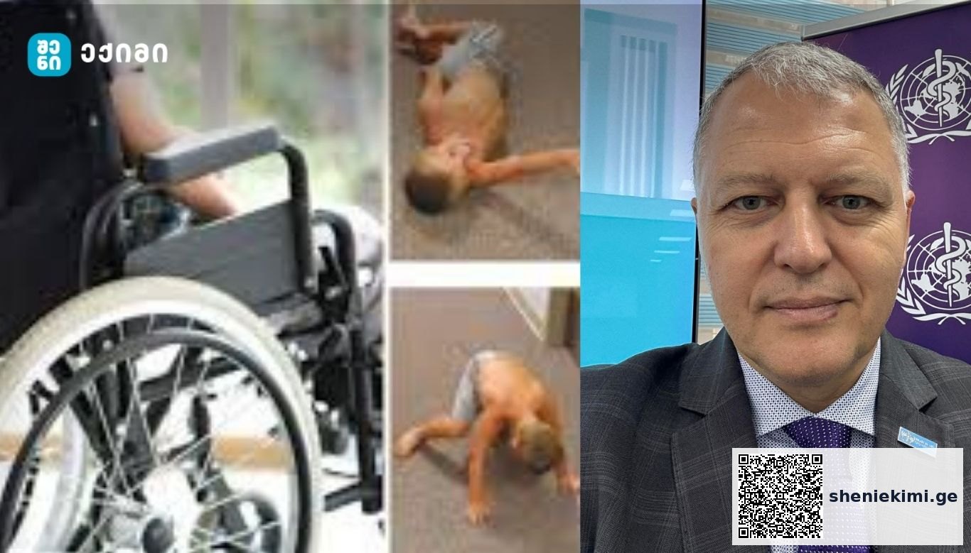 დუშენის კუნთოვანი დისტროფია — ფაქტები, რომლებიც უნდა იცოდეთ – „ორი გარდაცვალება ვნახეთ შეერთებულ შტატებში და არამარტო – სხვა ქვეყნებშიც უკვე ძალიან დიდი გართულებებია“ | sheniekimi.ge | შენი ექიმი