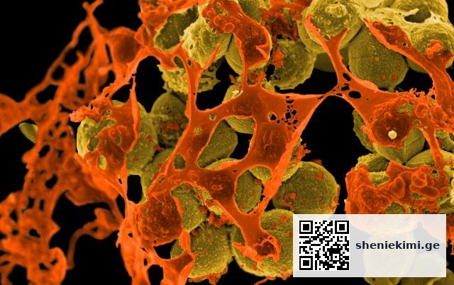 MRSA კვლავ რჩება ანტიმიკრობული რეზისტენტობის ერთ-ერთ მთავარ საფრთხედ — რა უნდა იცოდნენ კლინიცისტებმა და პაციენტებმა | sheniekimi.ge | შენი ექიმი